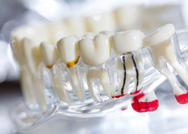 Why Root Canal Treatment Preserves Your Natural Teeth Better Than Extraction